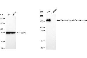 Western blotting analysis using Epidermal growth factor receptor antibody (ABIN7798477).