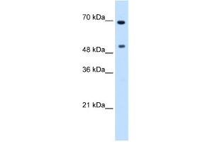 WB Suggested Anti-MYC Antibody Titration:  0. (c-MYC antibody  (N-Term))