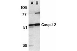 Western blot analysis of caspase-12 in human (A) and mouse (B) spleen tissue lysates with AP30190PU-N caspase-12 antibody at 1 μg/ml. (Caspase 12 antibody  (N-Term))