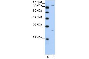 PTGS1 antibody used at 5 ug/ml to detect target protein. (PTGS1 antibody)