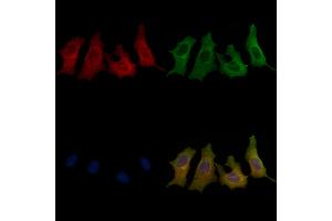 ABIN6258284 and ABIN6273886 staining HepG2 cells by IF/ICC.