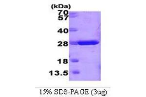 Figure annotation denotes ug of protein loaded and % gel used. (GSTM1 Protein (AA 1-218))