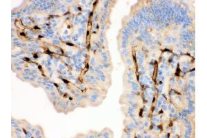 Immunohistochemistry (Paraffin-embedded Sections) (IHC (p)) image for anti-Fatty Acid Binding Protein 4, Adipocyte (FABP4) (AA 10-40), (N-Term) antibody (ABIN3043827)