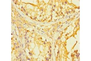 Immunohistochemistry of paraffin-embedded human testis tissue using ABIN7166699 at dilution of 1:100 (PAGE2B antibody  (AA 1-111))