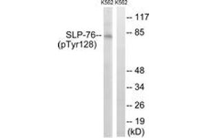 Western blot analysis of extracts from K562 cells treated with Na3VO4 0. (LCP2 antibody  (pTyr128))