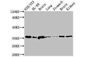 Western Blot Positive WB detected in: NIH/3T3 whole cell lysate, HL60 whole cell lysate, Rat brain tissue, Rat lung tissue, Rat stomach tissue, Mouse brain tissue, Mouse kidney tissue All lanes: JUN antibody at 3 μg/mL Secondary Goat polyclonal to rabbit IgG at 1/50000 dilution Predicted band size: 36 kDa Observed band size: 36 kDa (C-JUN antibody  (AA 1-100))