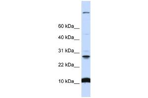 WB Suggested Anti-C19orf56 Antibody Titration:  0. (C19orf56 antibody  (N-Term))