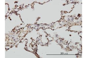 Immunoperoxidase of monoclonal antibody to EML2 on formalin-fixed paraffin-embedded human lung. (EML2 antibody  (AA 1-427))