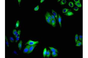 Immunofluorescent analysis of HepG2 cells using ABIN7173245 at dilution of 1:100 and Alexa Fluor 488-congugated AffiniPure Goat Anti-Rabbit IgG(H+L) (TMEM59 antibody  (AA 59-201))