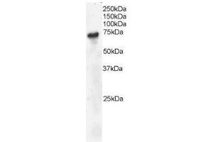 Image no. 2 for anti-B-Cell Linker (BLNK) (C-Term) antibody (ABIN374092) (B-Cell Linker antibody  (C-Term))
