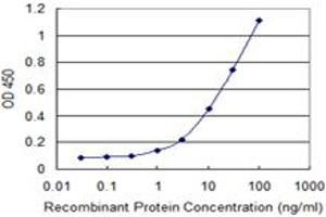Detection limit for recombinant GST tagged MBD1 is 0. (MBD1 antibody  (AA 415-508))