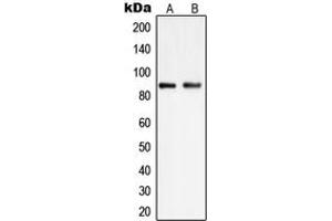 Western blot analysis of PIP5K1C expression in HEK293 (A), K562 (B) whole cell lysates. (PIP5K1C antibody  (Center))
