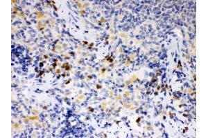 Anti- ATG14L Picoband antibody, IHC(P) IHC(P): Rat Spleen Tissue (ATG14 antibody  (N-Term))