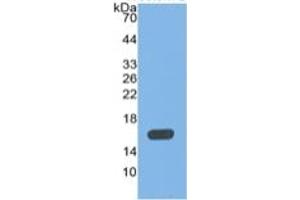 WB of Protein Standard: different control antibodies  against Highly purified E. (MBL2 ELISA Kit)