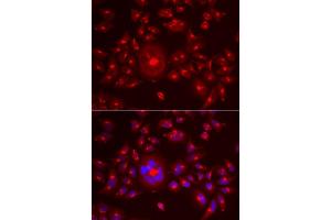 Immunofluorescence analysis of A549 cell using GORASP1 antibody. (GORASP1 antibody)