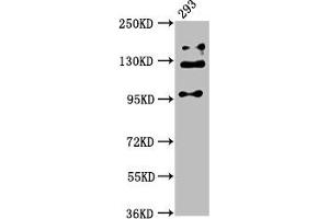 Western Blot Positive WB detected in: 293 whole cell lysate All lanes: RAB3GAP2 antibody at 5 μg/mL Secondary Goat polyclonal to rabbit IgG at 1/50000 dilution Predicted band size: 156, 24 kDa Observed band size: 110, 130, 150 kDa (RAB3GAP2 antibody  (Catalytic Subunit))