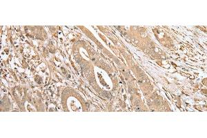 FNDC3B antibody