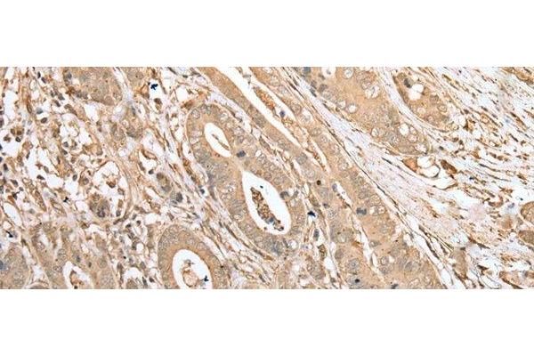 FNDC3B antibody