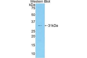 Detection of Recombinant F5, Mouse using Polyclonal Antibody to Coagulation Factor V (F5) (Coagulation Factor V antibody  (AA 364-611))