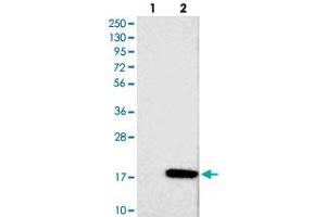 Western blot analysis of Lane 1: Negative control (vector only transfected HEK293T lysate), Lane 2: Over-expression Lysate (Co-expressed with a C-terminal myc-DDK tag (~3. (FAM19A1 antibody)