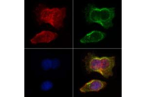 ABIN6264652 and ABIN6266628 staining HepG2 by IF/ICC. (RASH/RASK/RASN (N-Term) antibody)