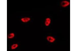 ABIN6267287 staining MDA-MB-435 by IF/ICC. (p53 antibody  (pSer20))