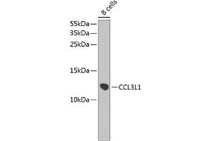 Western blot analysis of extracts of B-cell cells, using CCL3L1 antibody (ABIN3016836, ABIN3016837, ABIN3016838 and ABIN6219853) at 1:1000 dilution. (CCL3L1 antibody  (AA 24-93))