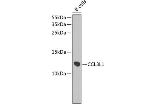 CCL3L1 抗体  (AA 24-93)