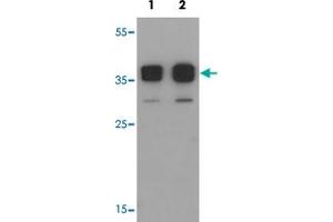 Western blot analysis of TSPY1 in A-20 cell lysate with TSPY1 polyclonal antibody  at (1) 0. (TSPY1 antibody  (C-Term))