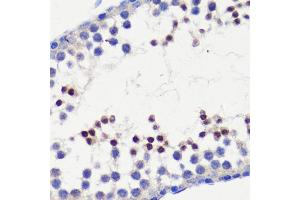 Immunohistochemistry of paraffin-embedded mouse testis using HFM1 antibody (ABIN6133318, ABIN6141741, ABIN6141743 and ABIN6224711) at dilution of 1:100 (40x lens). (HFM1 antibody  (AA 1-240))