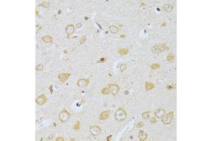 Immunohistochemistry of paraffin-embedded rat brain using CHRNA7 antibody. (CHRNA7 antibody)