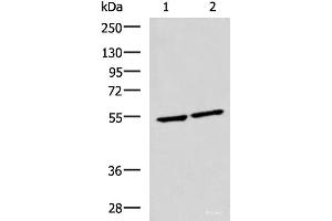 Western blot analysis of Raji and Jurkat cell lysates using IRF2 Polyclonal Antibody at dilution of 1:1350 (IRF2 antibody)
