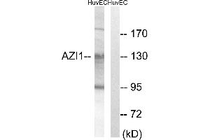 Immunohistochemistry analysis of paraffin-embedded human breast carcinoma tissue using AZI1 antibody. (AZI1 antibody)