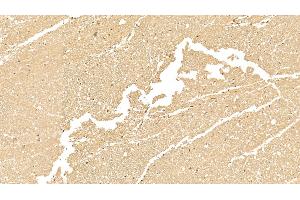 Immunohistochemistry (IHC) image for anti-Keratin 18 (KRT18) (AA 238-396) antibody (ABIN7426868)