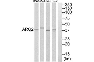 Western Blotting (WB) image for anti-Arginase, Type II (ARG2) (C-Term) antibody (ABIN1850798) (ARG2 antibody  (C-Term))