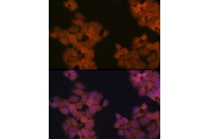 Immunofluorescence analysis of HeLa cells using CDC23 Rabbit mAb (ABIN7266247) at dilution of 1:100 (40x lens).