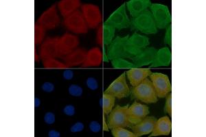 ABIN7095250 and ABIN7099307 staining Hela cells(30 min of UV treatment) by IF/ICC. (CKAP5 antibody)