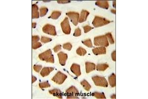 Formalin-fixed and paraffin-embedded human skeletal muscle reacted with TBC1D4 Antibody (N-term), which was peroxidase-conjugated to the secondary antibody, followed by DAB staining. (TBC1D4 antibody  (N-Term))