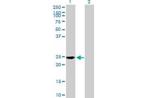 Western Blot analysis of RAB39 expression in transfected 293T cell line by RAB39 MaxPab polyclonal antibody. (RAB39 antibody  (AA 1-217))