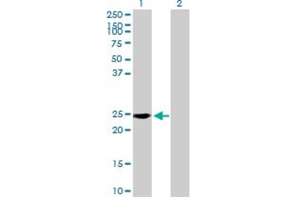 RAB39 antibody  (AA 1-217)
