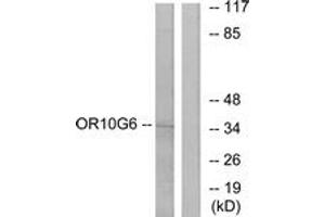 Western blot analysis of extracts from COLO cells, using OR10G6 Antibody. (OR10G6 antibody  (AA 261-310))