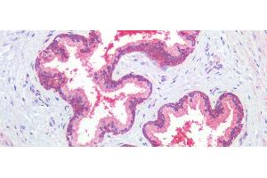 Detection of TGFb3 in Human Prostate Tissue using Polyclonal Antibody to Transforming Growth Factor Beta 3 (TGFb3)