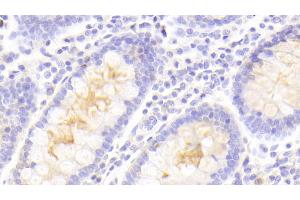 Detection of PLIN4 in Human Colon Tissue using Polyclonal Antibody to Perilipin 4 (PLIN4) (PLIN4 antibody  (AA 349-656))