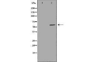 Western blot analysis of extracts of mouse kidneytissue, using CBS antibody.
