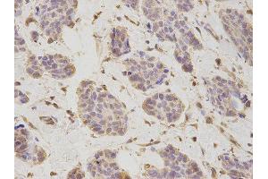 Immunohistochemistry (IHC) image for anti-Proteasome (Prosome, Macropain) 26S Subunit, Non-ATPase, 2 (PSMD2) antibody (ABIN1874389) (PSMD2 antibody)