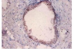 Immunohistochemistry of paraffin-embedded human prostate tissue using ABIN7159368 at dilution of 1:100 (PKMYT1 antibody  (AA 900-1101))