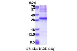 SDS-PAGE (SDS) image for Glutamate Decarboxylase 1 (Brain, 67kDa) (GAD1) (AA 1-224) protein (His tag) (ABIN5853654) (GAD Protein (AA 1-224) (His tag))