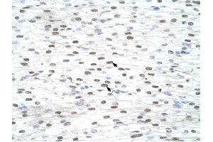 LSM2 antibody was used for immunohistochemistry at a concentration of 4-8 ug/ml to stain Myocardial cells (arrows) in Human Heart. (LSM2 antibody)