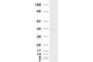 Validation with Western Blot (MMAA Protein (Myc-DYKDDDDK Tag))