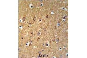 Immunohistochemistry (IHC) image for anti-Sphingomyelin Synthase 2 (SGMS2) antibody (ABIN3004329) (Sphingomyelin Synthase 2 antibody)